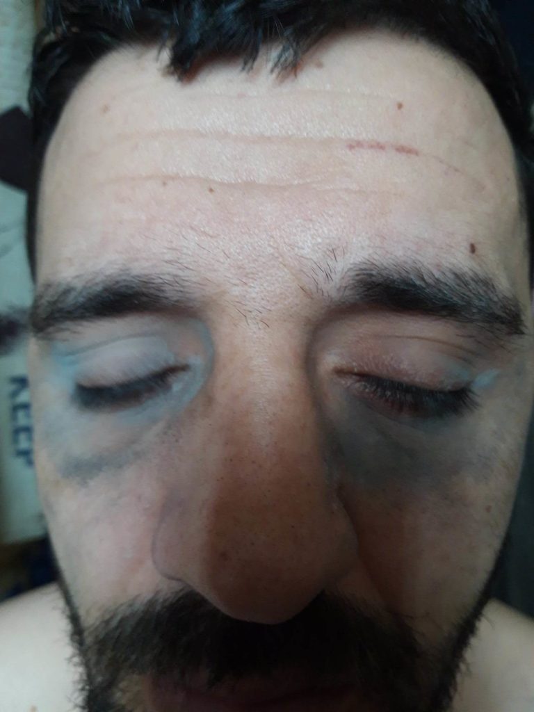 Ο βασανισμός του Σ. Πρέλα: Οκτώ ώρες δεμένος πισθάγκωνα, με κράνος στο κεφάλι- «Με χτυπούσαν με γκλοπ, χέρια και πόδια»