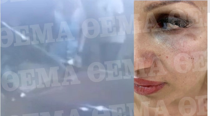 Θέμης Αδαμαντίδης: Βίντεο και φωτογραφία ντοκουμέντα από τα χτυπήματα στη Βαρβάρα Κίρκη
