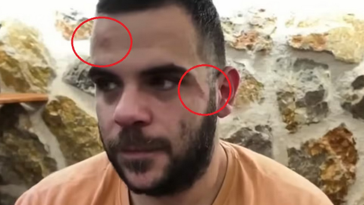 Ξυλοκόπησαν γνωστό YouTuber σε ζωντανή μετάδοση